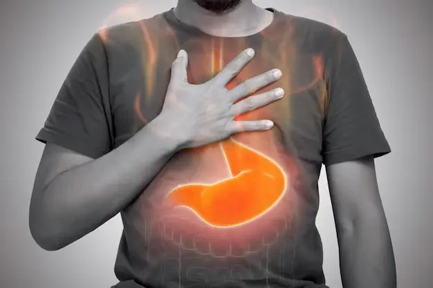 Acid Reflux vs. GERD: What's the Difference?